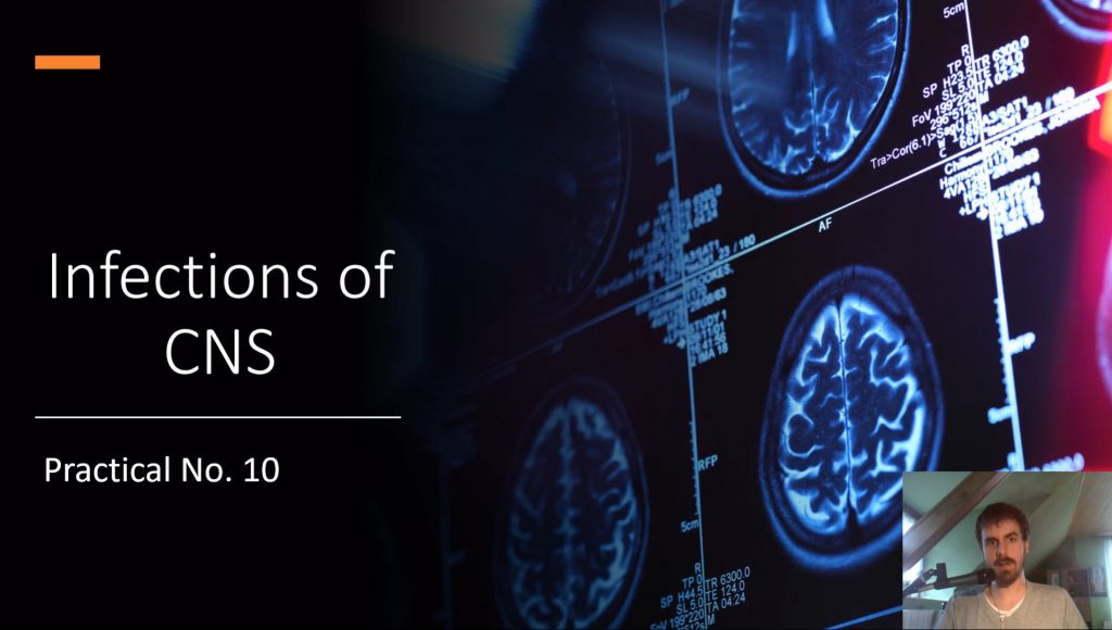 Practical No. 10 - Infections of CNS