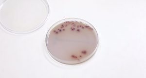 Mikrobiológia 2 (VL)