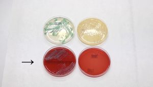 PC č. 4 – Ochorenia v dutine ústnej 2