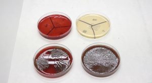 PC č. 8 – Mikrobiologická diagnostika septických stavov a endokarditíd odontogénnej etiológie