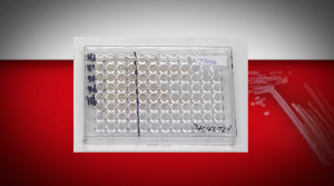 PC č. 5 –  Ochorenia v dutine ústnej 3