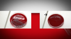 PC č. 6 – Mikrobiologická diagnostika infekcií dýchacieho traktu