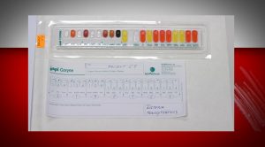 PC č. 10 – Mikrobiologická diagnostika infekcií CNS